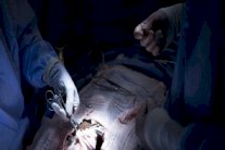 هذا هو الجانب المظلم لتجارة الأعضاء في إيران