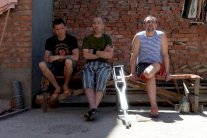 مشوهو الحرب الاوكرانية يعالجون في روسيا بالمجان