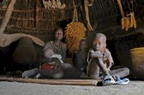  وفاة 39 شخصا بالكوليرا في جنوب السودان