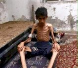 أهل مضايا السورية يموتون جوعا في انتظار المساعدات