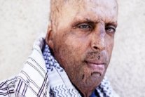 تونسي حاول إحراق نفسه: أشعر بالندم