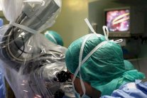 للمرة الاولى بالمغرب... عملية فصل نصفي الدماغ