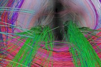 اختبارات دماغية تتنبأ بمستقبل الأطفال