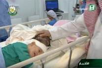 السعودية: نجاح عملية فصل التوأم السوري من الرأس