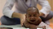  البرازيل: وفاة 139 طفلًا وتشوه 641 آخرين جراء زيكا 