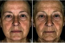 العلماء يكتشفون الجين الذي يمنح الوجه ملامح الشباب