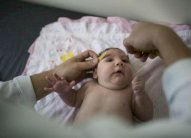 تسجيل أول إصابة بزيكا في ألمانيا