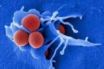 عقار يقتل البكتيريا والفيروسات المقاومة للمضادات الحيوية