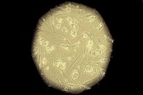 إحياء الأنسجة التالفة عبر حقنها بالخلايا الجذعية