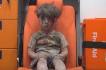 الطفل عمران ... رمزٌ جديد لمعاناة السوريين