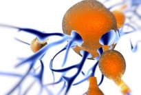 عقار لمرض الزهايمر يحير العلماء