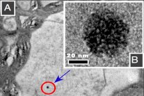 دراسة تربط بين تلوث البيئة والزهايمر