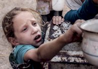 يونيسف: 1100 طفل يعانون من سوء تغذية في الغوطة الشرقية