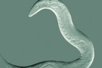 اكتشاف سر الشيخوخة وأمراضها