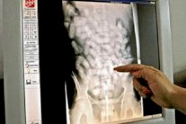 المغرب: 3230 غرامًا من الكوكايين في أمعاء 4 مواطنين اجانب