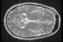جزء صغير من دماغك مسؤول عن تغيير رأيك