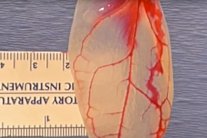 علماء يحوّلون اوراق السبانخ الى نسيج قلبي