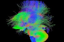 علماء يرسمون خريطة الدماغ البشري