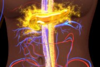 بنكرياس صناعي لمعالجة السكري