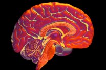 تنمية ادمغة صغيرة في المختبر لعلاج الزهايمر