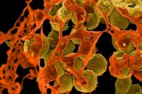 مضاد حيوي من التربة يقتل البكتيريا شديدة المقاومة