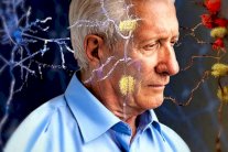 أمل جديد لعلاج الزهايمر