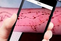 طفل مصري يتناول سم حشرات تنفيذًا لأوامر «الحوت الأزرق»