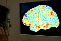 إبطال جين الزهايمر بتكنولوجيا تحرير الجينات