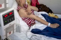 علماء: فيروس شلل الأطفال يعالج سرطان الدماغ