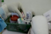 سلك مغناطيسي يكتشف السرطان قبل ظهور أعراضه