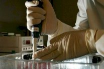 دواء جديد يحقق نتائج واعدة لعلاج الزهايمر