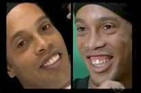 علاقة حب تُجبر رونالدينيو على الخضوع لعملية تجميل لأسنانه «فيديو»