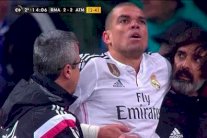 الإصابة تبعد بيبي عن ريال مدريد أكثر مما كان متوقعاً