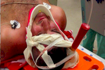 مشجعان إسرائيليان يعتديان على آخر بضربة فأس