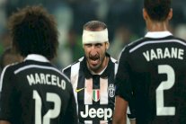 ضربة موجعة لليوفي بإصابة أبرز مدافعيه قبل نهائي برلين