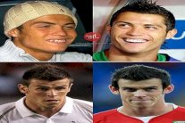 رونالدو وبيل أكثر اللاعبين خضوعاً لعمليات التجميل