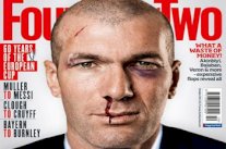 مجلة بريطانية: هذه أسباب وجود الكدمات في وجه زيدان؟!