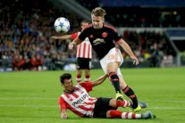 إصابة خطيرة للدولي لوك شو في مباراة يونايتد وايندهوفن