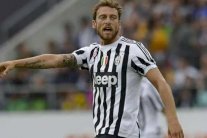 الإصابة تبعد ماركيزيو عن مباراة يوفنتوس ومانشستر سيتي