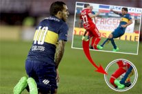 كارلوس تيفيز يتسبب بكسر مضاعف لساق منافسه