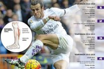 عضلة ساق غاريث بيل... صداع يؤرق ريال مدريد!