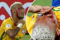 لكمة لاعب منتخب بوليفيا تغرق وجه نيمار في الدماء