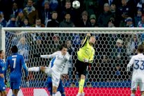 حارس ليستر سيتي شمايكل يتعرض لكسر في يده اليمنى