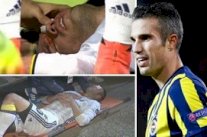 إصابة خطيرة لفان بيرسي... خرج ووجهه مغطى بالدماء!