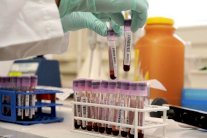 تحديات كبيرة تواجه جهود روسيا لمكافحة المنشطات برغم الاصلاحات