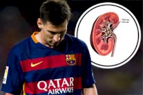 ميسي سيتبع علاجاً لتقييم وضع حصيات الكلى