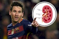 ميسي سيكون جاهزاً لخوض مواجهة سيلتافيغو بعد عملية 