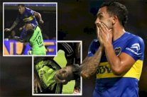 تيفيز المتهور يصيب حارس مرمى أرجنتيني بكسر في الفك 