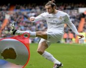 غاريث بيل يبتكر طريقة جديدة لتفادي الإصابة في العضلة النعلية