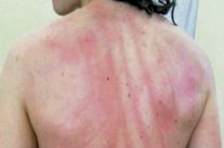 إصابات في اقتحام مشجعين لمباراة كروية للسيدات في إسبانيا